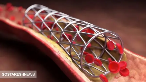 خوش به حالِ بیماران قلبی شد