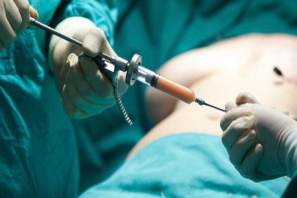 ۸۲ درصد تهرانیهای بالای ۳۰ سال دچار اضافه وزن یا چاقی هستند ۸۲ درصد تهرانیهای بالای ۳۰ سال دچار اضافه وزن یا چاقی هستند